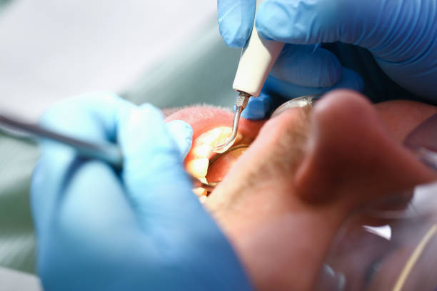 Best Emergency Treatment for Toothache in Blue Ridge, AL