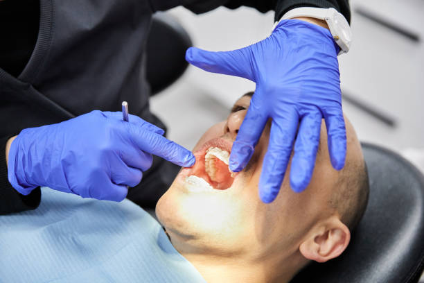Best Emergency Tooth Extraction in Blue Ridge, AL